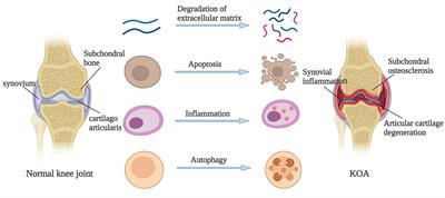 Mechanism of HIFs in osteoarthritis